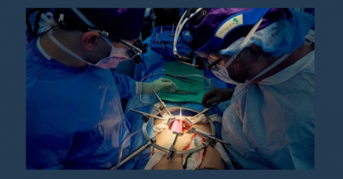 Who is Richard Slayman? US surgeons transplant world's