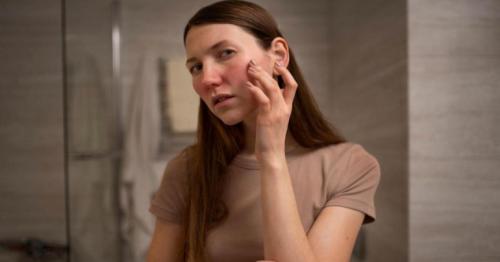 UAE: Itchy during winters? Breakouts, dry skin conditions